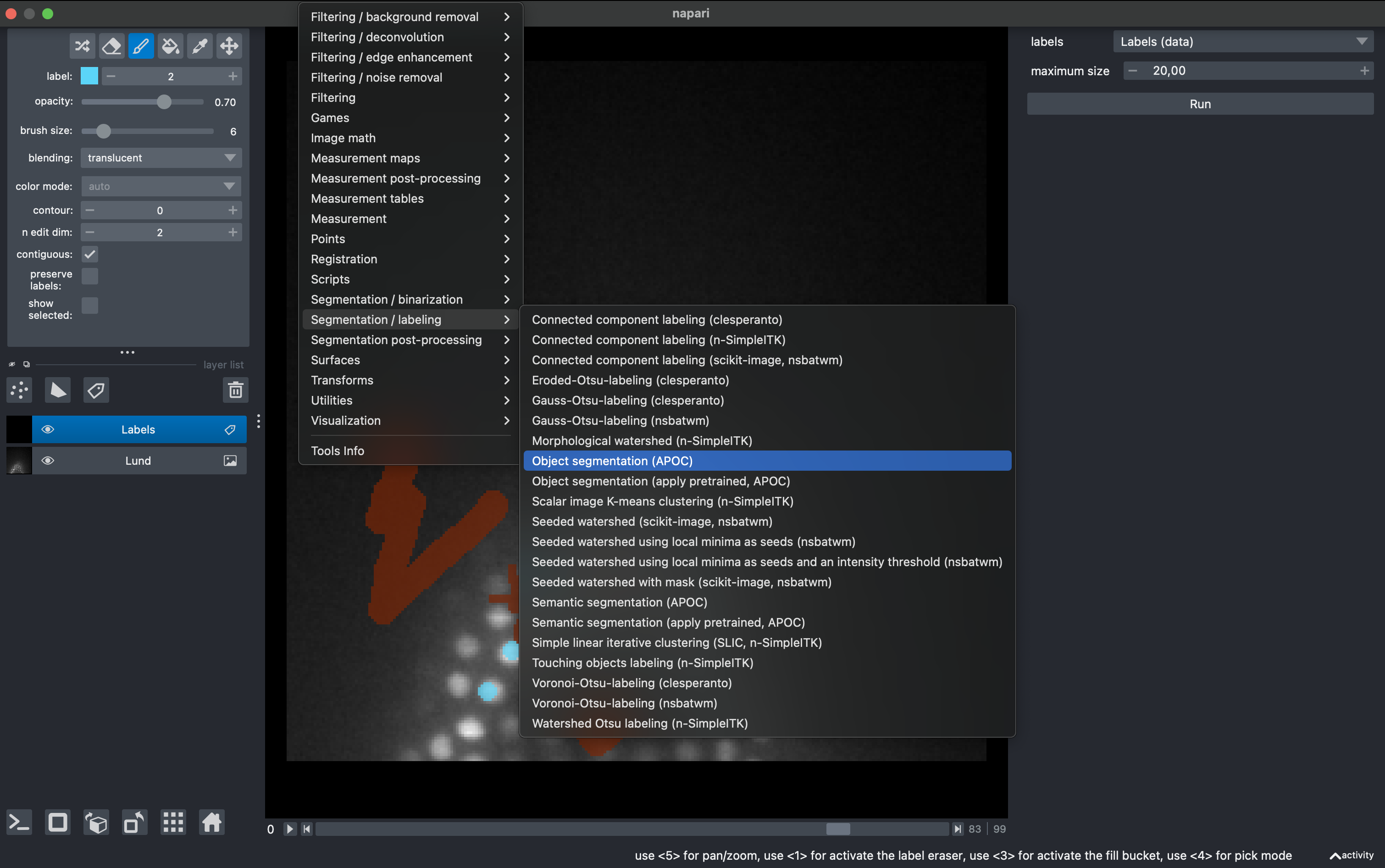 Brightness/Contrast histogram