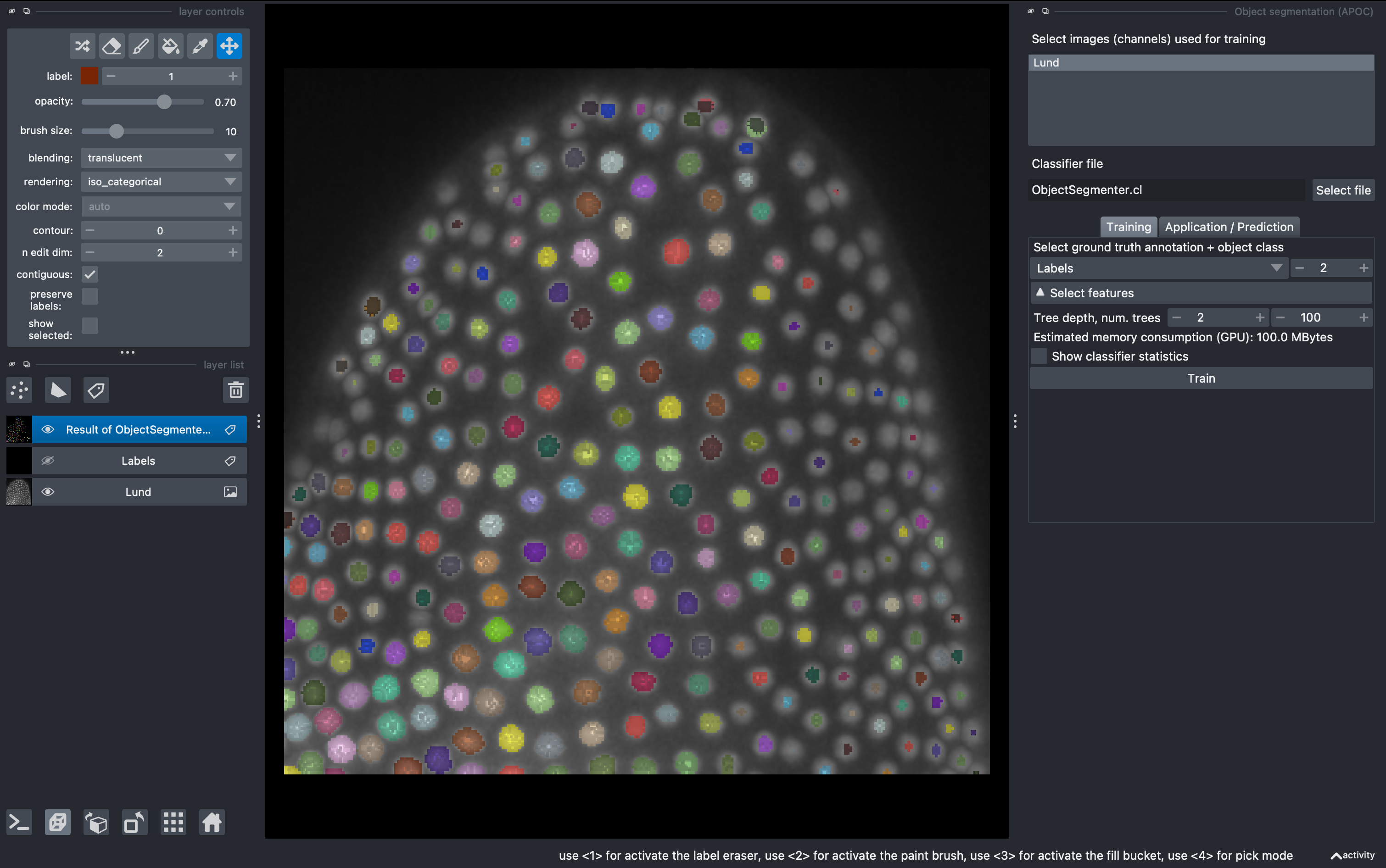 Observe labels result