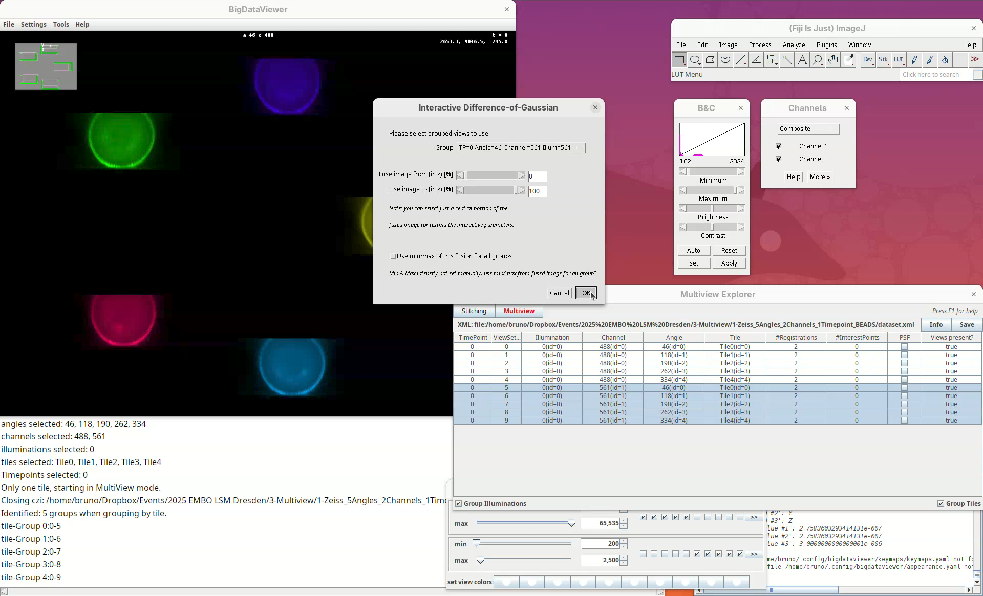 Multiview reconstruction in Fiji using BigStitcher
